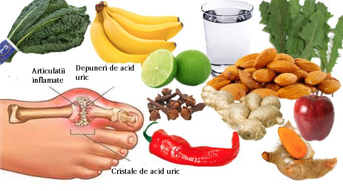 Regimul alimentar al bolnavului de gută