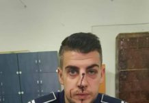 Polițist bătut de un tânăr din Balș