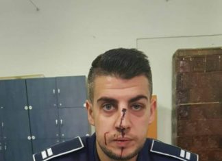 Polițist bătut de un tânăr din Balș