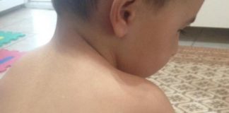 Copii mușcați și bătuți într-o grădiniță din Olt