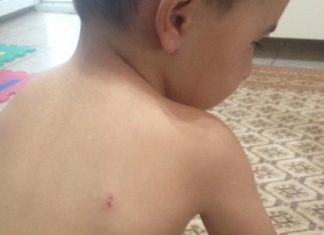 Copii mușcați și bătuți într-o grădiniță din Olt