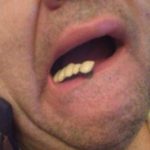 presedintele PRCorabia desfigurat in trafic 1