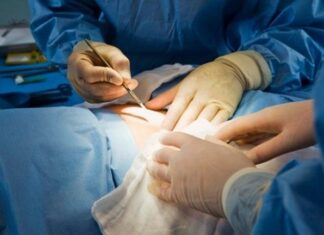 Oltencele diagnosticate cu cancer de sân beneficiază gratuit de reconstrucție mamară