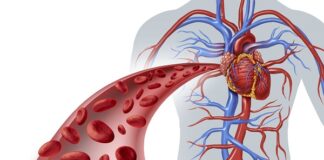 Șase simptome care prevestesc un infarct. Pot apărea cu cu o lună înainte