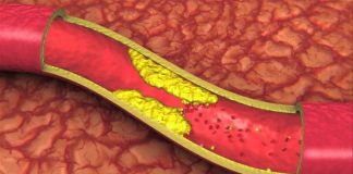 Alimentele care îți distrug organismul în doar nouă zile. Îngustează arterele și încetinesc metabolismul