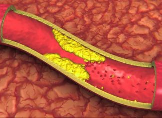Alimentele care îți distrug organismul în doar nouă zile. Îngustează arterele și încetinesc metabolismul