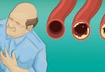 Plantele care scad colesterolul. Remedii naturale împotriva unui adversar de temut