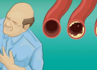 Plantele care scad colesterolul. Remedii naturale împotriva unui adversar de temut