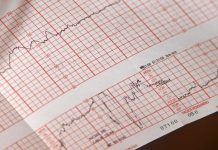 De ce apar palpitațiile? Principalele cauze ale aritmiilor