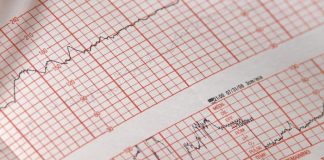 De ce apar palpitațiile? Principalele cauze ale aritmiilor