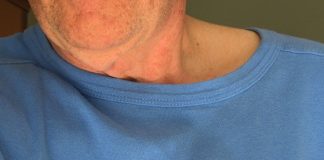 Cum se manifestă un atac de panică și de ce este confundat cu infarctul