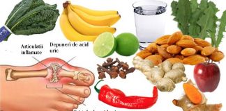 De ce apare guta, ”boala oamenilor bogați”