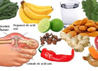 De ce apare guta, ”boala oamenilor bogați”