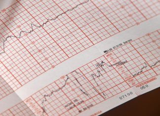 De ce apar palpitațiile? Principalele cauze ale aritmiilor