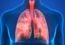 Pneumonia, boala foarte gravă care, netratată, poate duce la deces. Simptomele, cauzele și factorii de risc