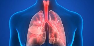 Pneumonia, boala foarte gravă care, netratată, poate duce la deces. Simptomele, cauzele și factorii de risc