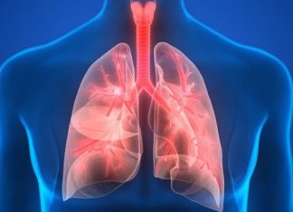 Pneumonia, boala foarte gravă care, netratată, poate duce la deces. Simptomele, cauzele și factorii de risc