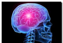 Accidentul vascular cerebral, pe înțelesul tuturor. Cum îl prevenim și ce semne trebuie să ne îngrijoreze