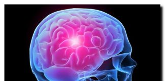 Accidentul vascular cerebral, pe înțelesul tuturor. Cum îl prevenim și ce semne trebuie să ne îngrijoreze