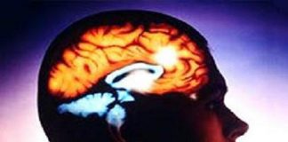 Efect dovedit! Alimentele care te ajută să previi accidentul vascular cerebral