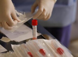 Două femei din Slatina, confirmate cu COVID-19