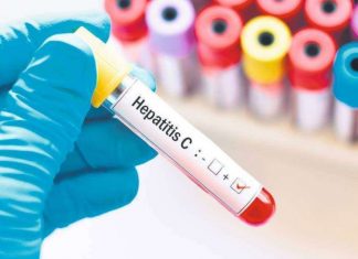 Tratamentul fără interferon pentru oltenii cu Hepatită, în farmaciile Catena din județ