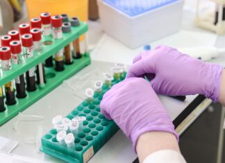 Alți doi olteni, confirmați cu SARS-COV2