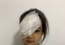 Micuța Cristina, fetița cu pleoapa dreaptă căzută, a fost operată