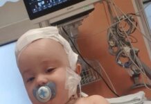 Cezar, bebelușul cu cancer la cap, are banii pentru tratament!