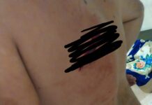 Potcoava: Tânăr tăiat cu cuţitul, în plină stradă