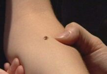 Zeci de olteni înțepați de căpușe