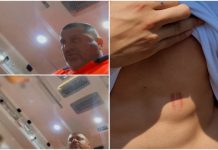 Olt: Un adolescent a fost lovit în ambulanță de un angajat