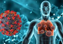 Alertă în România: Primul caz de virus Chikungunya confirmat la un pacient revenit din Africa