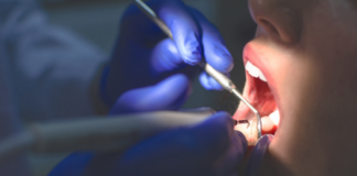 5 probleme dentare care pot fi descoperite la un control de rutină